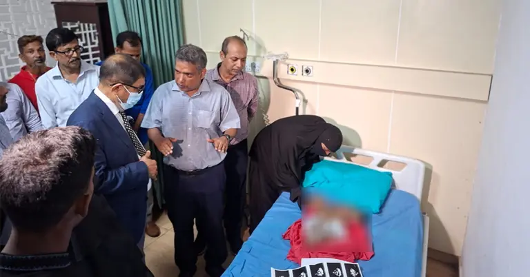 পেট জোড়া লাগানো ২ শিশুকে দেখতে ঢাকা মেডিকেল কলেজ হাসপাতালে স্বাস্থ্যমন্ত্রী